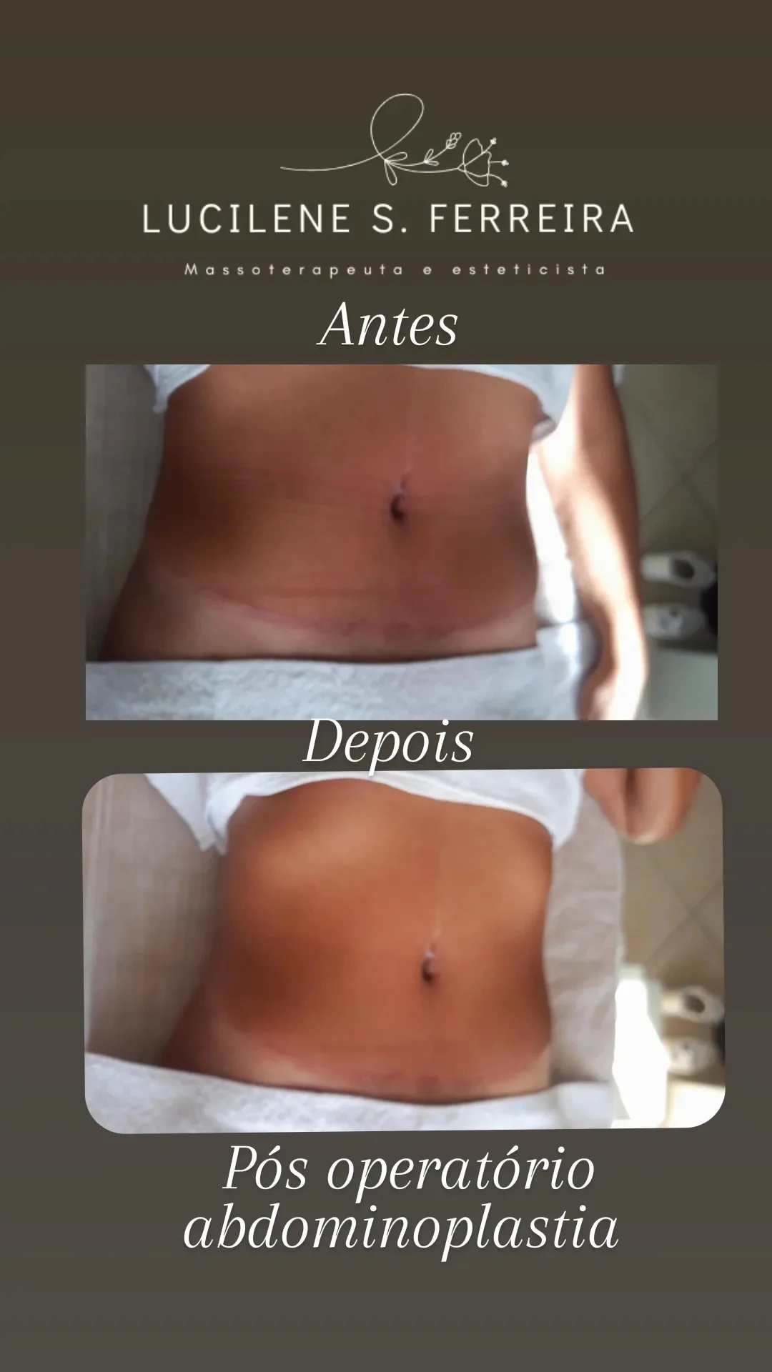 Imagem 3 - Lucilene Massoterapeuta